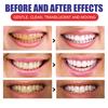 EELHOE Teeth Cleansing Whitening Mousse Deep Cleaning Toothpaste Foam Toothpaste Removes Stains Fresh Breath Dental Care Tools 100g