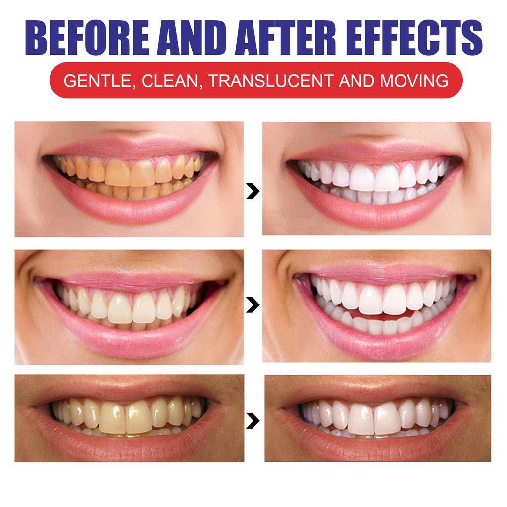 EELHOE Teeth Cleansing Whitening Mousse Deep Cleaning Toothpaste Foam Toothpaste Removes Stains Fresh Breath Dental Care Tools 100g