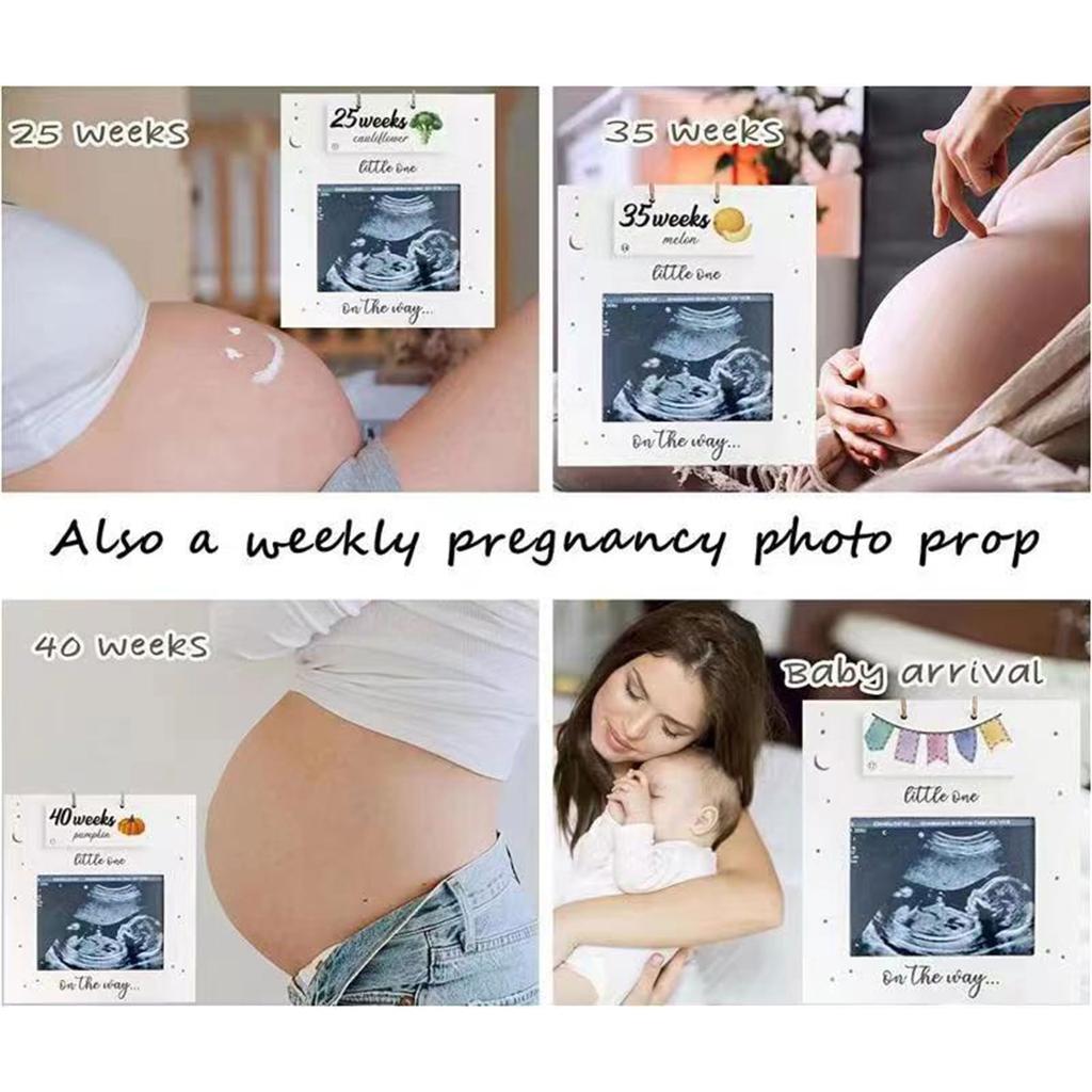 Baby Ultrasound Photo Frame Sonogram Picture Frame Pregnancy Gift Baby Announcement Keepsake For Couples New Moms Dady