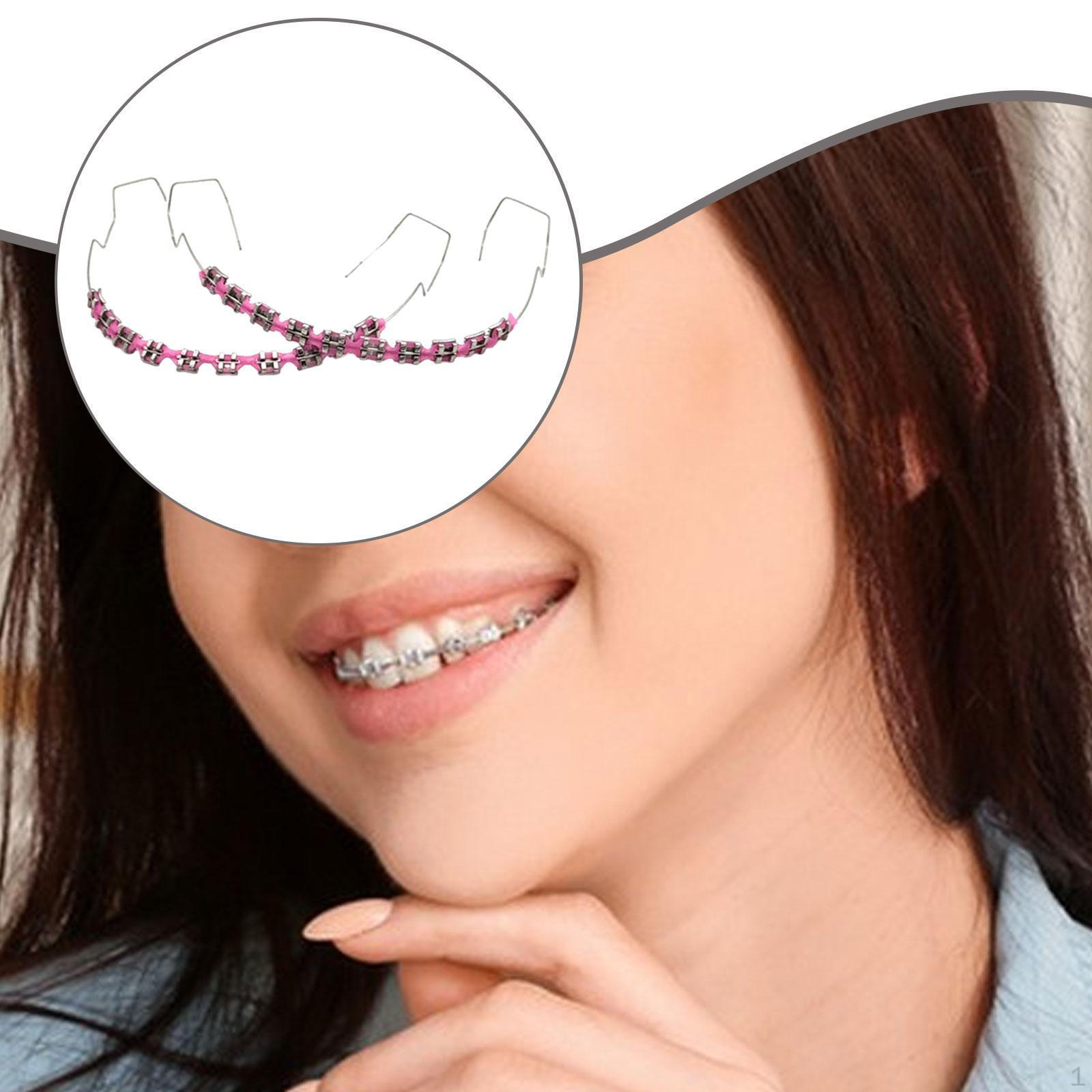 

Временное украшение зубов Модные брекеты для вечеринок Взрослые Музыкальный фестиваль розовый