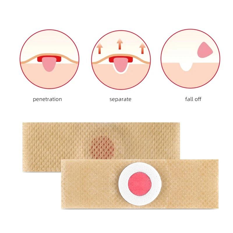 1/6/10/50/100PCS Foot Care Sticker Medical Patch Corn Removal Pads Curative Patches Calluses Remove Callosity Detox Summer Foot Care Tools