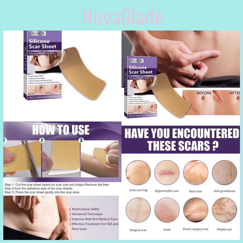 Eelhoe Silikon Narbenpflaster zur effektiven Reduzierung von Schwangerschafts- und Kaiserschnittnarben