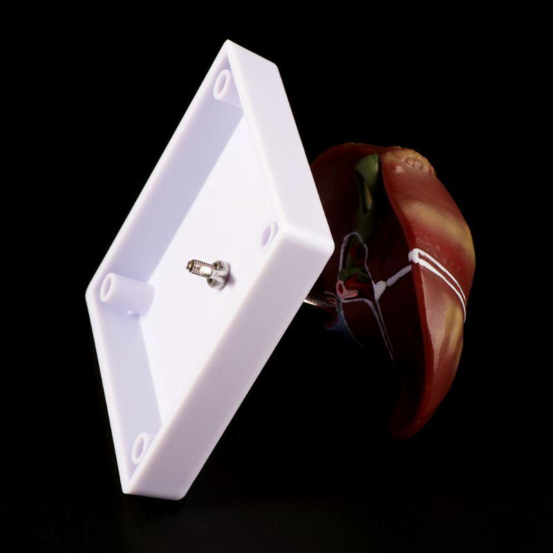 Pathologisches anatomisches Modell der menschlichen Leber, Anatomieschule, medizinisches Lehrdisplay, Laborausrüstung