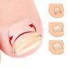 Ingrown Double Ended Ingrown Toe Correction Lifter File Manicure Pedicure Toenails Clean Foot Care Toe Nail Care Hook