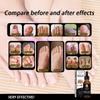 EELHOE Nail Repair Lotion – Brighten Nails, Remove Gray Nails, Repair and Moisturize, Nutritious Nail Care Solution