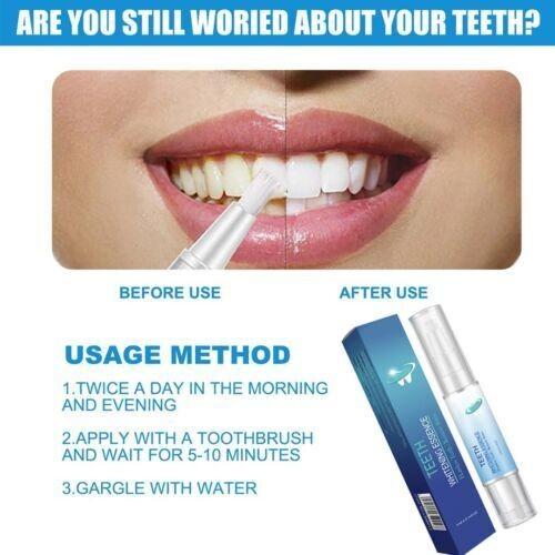 Care To Remove Yellow Teeth And  Teeth To Yellow And Black Stains Tooth Cleaning Pen Beauty Tooth Pen Gel 4ml