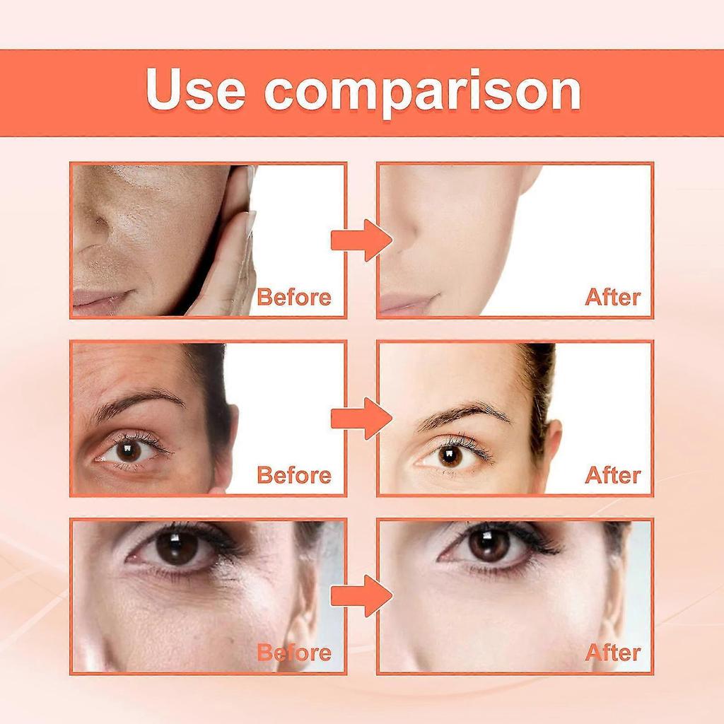 25-26 Eelhoe - 2pack Vitamin C Rose Oil Improve Tone, Firmness And Complexion, Anti Deep Wrinkle, Brighten & Firm, Anti-aging Daily Serum