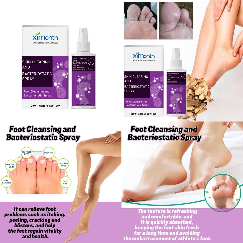 Ximonth Foot Care Spray Refreshing Odor Eliminating Formula For Sweaty Feet And Itch Relief