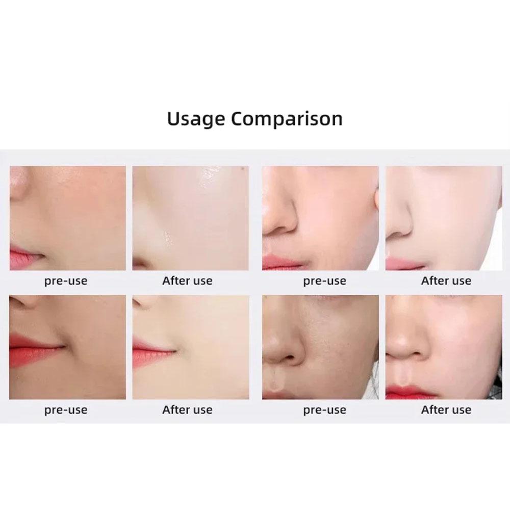 Przenośne urządzenie do pielęgnacji urody CO2 Bubble, zestaw do pielęgnacji twarzy z kapsułkami dotleniającymi, do wielokrotnego ładowania