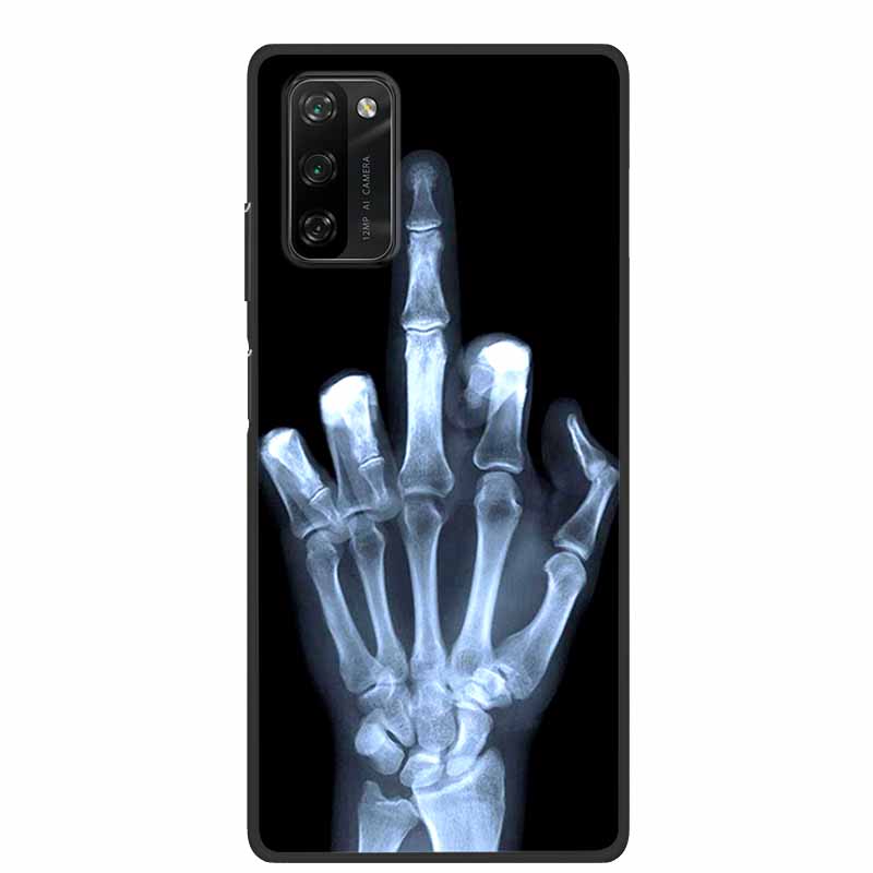 Per Custodia Blackview A100 Animali Morbido Silicone TPU Cover Posteriore per BlackviewA100 Lupo Antiurto Protezione Paraurti Capa