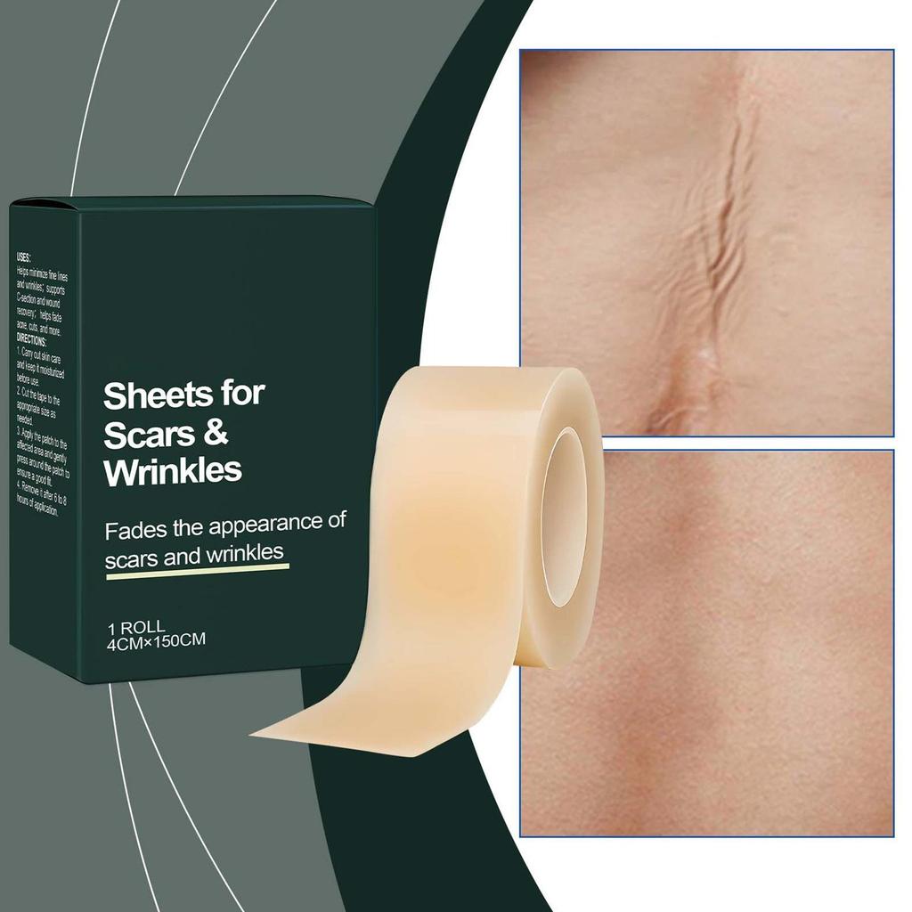 Silicone Scar Sheets Silicone Scar Remover Tape Self Adhesive Scar Cover Tape Cuttable Beauty Skin Care Patches for Burn Recover