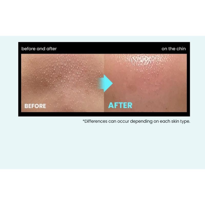 ilso - Super Melting Sebum Softener Special Set