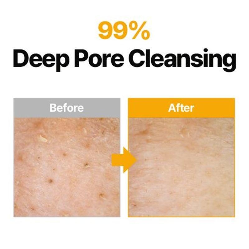 [ma:nyo] *TIMEDEAL* Pure Cleansing Oil 200ml