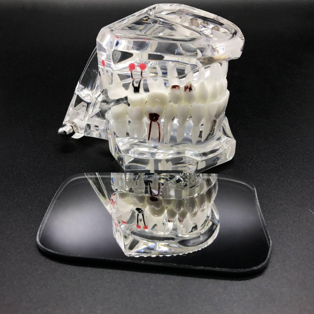 5Pcs/set Glass Intraoral Dental Reflector Double-Sided Mirror Intra Oral Reflector Dentistry