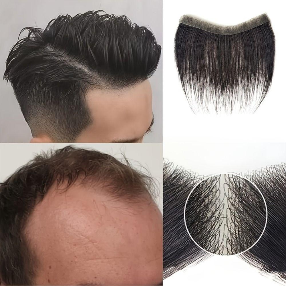 Seamless Natural Human Hair Patch Forehead Biological Scalp Patch  for Baldness Frontline