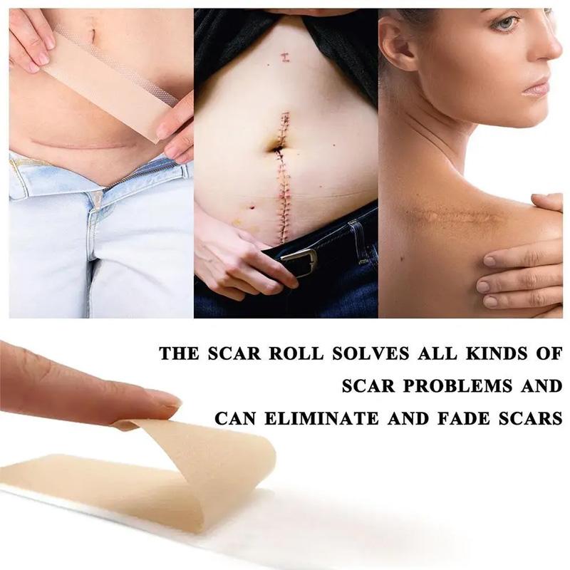 1 Roll Patch Skin Repair Self Adhesive 4X150CM Waterproof Scar Tape Non-slip Scar Sheets Skin Beauty Care Silicone Gel