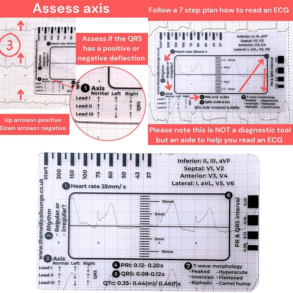 Portable ECG EKG 7 Step Ruler Card ECG/EKG Interpretation Tool For Easy ECG EKG Interpretation Heart Health Assessment