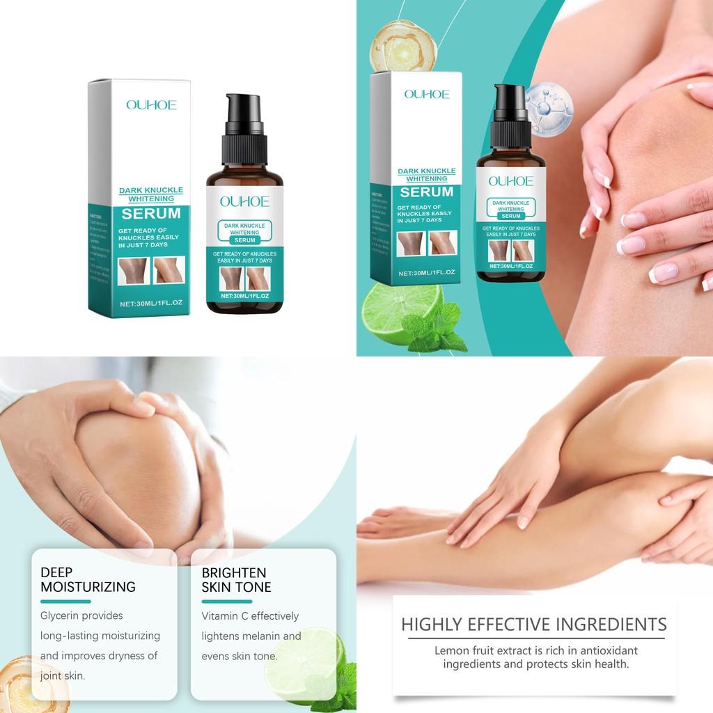 Ouhoe Joint Skin Essence 30ml Hydrating Moisturizing Brightening Skin Serum For Dry Skin