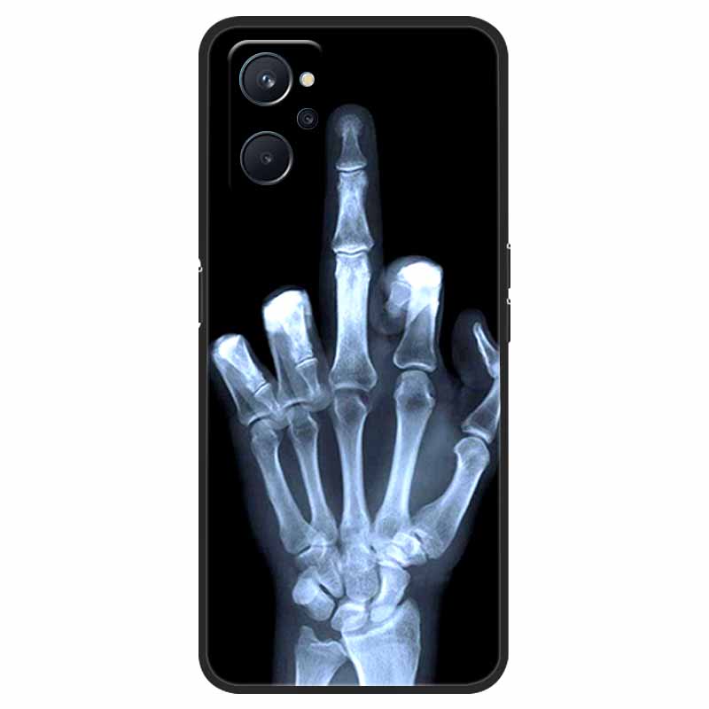För Coque realme 9i Fodral Stötsäker Mjuk silikon TPU Baksida För oppo realme 9i 9 i i9 Realme9i Telefonfodral 9i Söt tecknad film