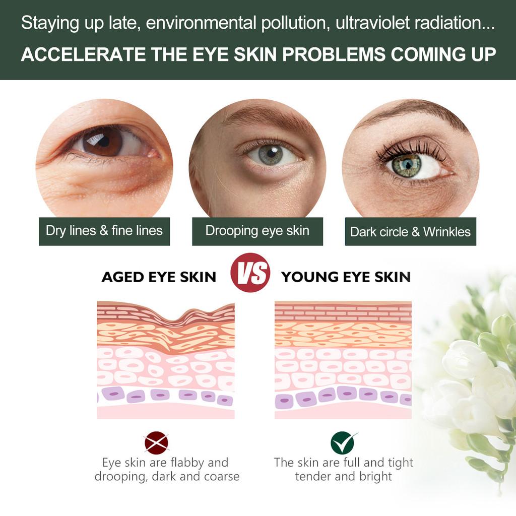 Jasmine Flower Anti-aging Eye Cream For Fine Lines And Puffiness Hydrating Complexion