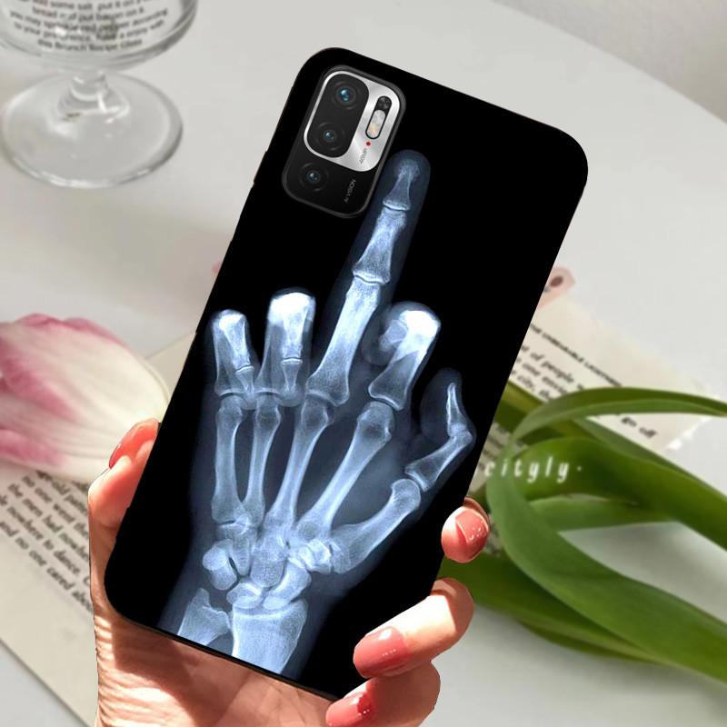Für Redmi Note 10 5G Hülle M2103K19C Tier Silikon Weiches TPU Handyhüllen Für Xiaomi Poco M3 Pro 5G Stoßfest Bumper Fundas