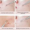 4Pcs/Set Acne Blackhead Needle Set Unscented Blemish PoreCleanser Needle Hook Spot Pimple Remover Skin Care Tools Accessories