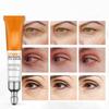 Vitamin C Brightening Eye Serum For Dark Circles Puffiness And Fine Lines In 20ml