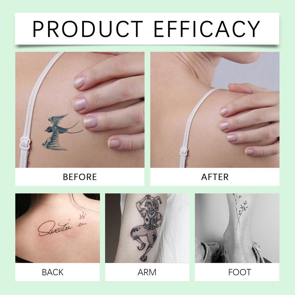 Eelhope Professional Tattoo Covering Care Set With Nourishing Repair Spray And Cream For All Skin Types