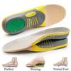 Premium Orthotic Gel Insoles Orthopedic Flat Foot Health Sole Pad For Shoes Insert Arch Support Pad For Plantar Fasciitis Unisex