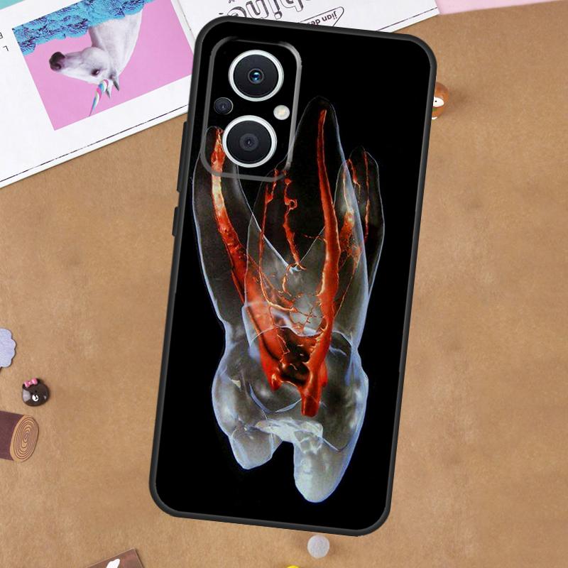 Human Tooth Anatomy Case For OPPO Reno 11 10 Pro 8 7 6 5 4 Lite 8T 5Z 4Z 11F OPPO Find X5 X6 Pro X2 Neo X3 Lite