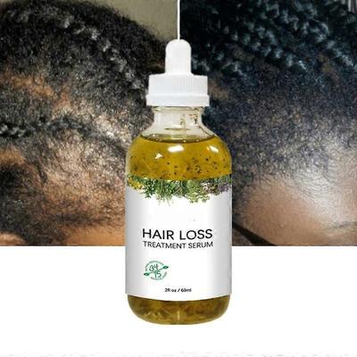 Cura di capelli e cuoio capelluto – Rimedi per la caduta dei capelli