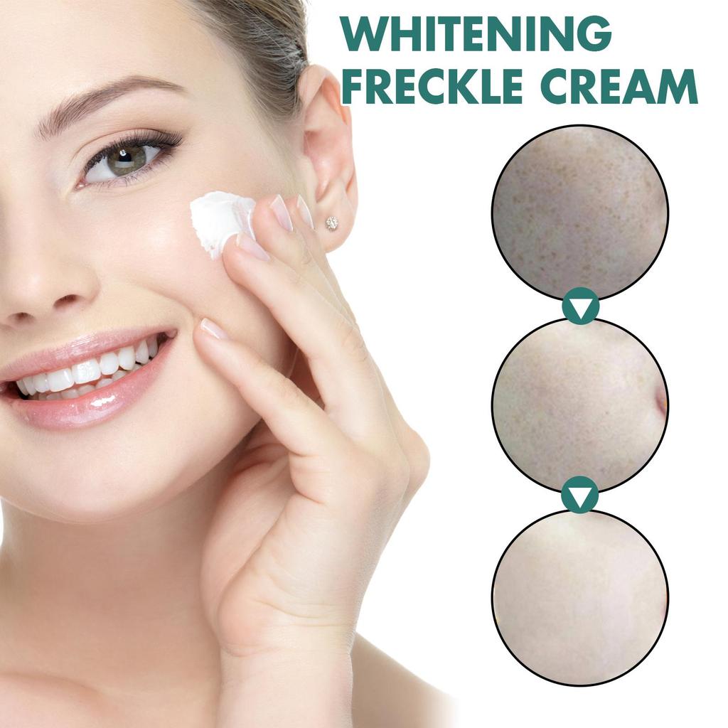 EELHOE Nicotinamid-Sommersprossencreme, feuchtigkeitsspendende Gesichtsaufhellungsreparatur, Hautpflege, Melasma-Entferner, Pigmententfernungscreme, 30 g