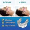 Snore Guard - Anti-snoring Mandibular Mouthpiece Device Sleep Apnoea Aid_PHC02 2025