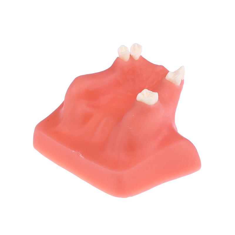 Maxillary Sinus Teeth Model Dental Implant Teaching Model For Dentist Student Practice Studying Oral Medical Model