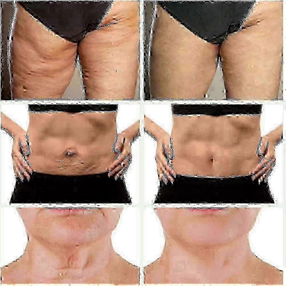 3pcs Retinol Anti-aging Body Cream, Anti Wrinkle Firming Moisturizer for Cellulite & Sagging Skin Care