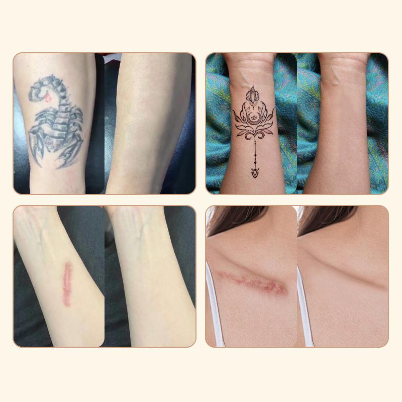 15 Sheets Tattoo Cover Up Patch Tattoo Masking Tape Ultra Thin Patch For Tattoo Scar And Birthmarks Invisible Waterproof Skin