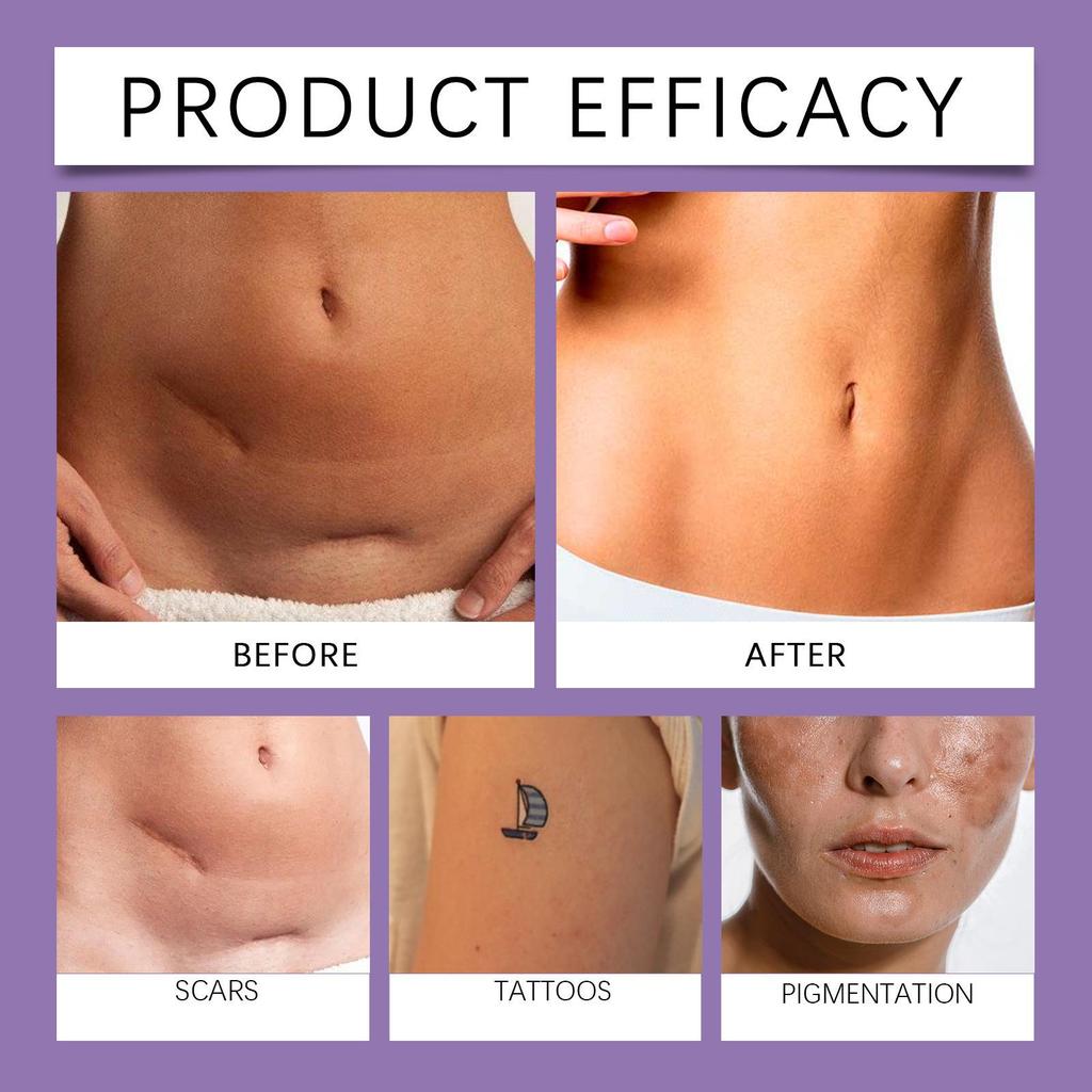 Waterproof Tattoo & Scar Concealer: Full Coverage Body Makeup