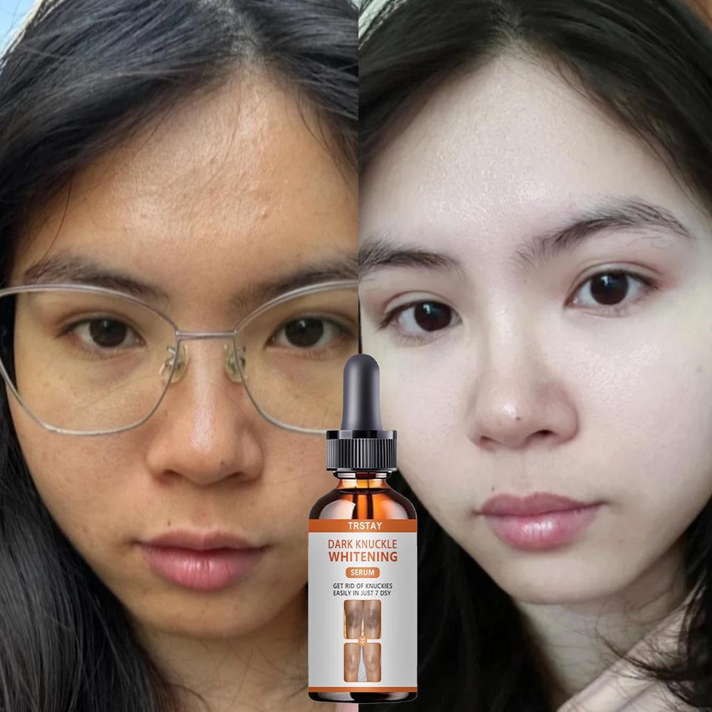 Collagen Complex Serum Face Blemish Skin Repair Essence Hydratační bělící zpevňující Zlepšení pružnosti obličeje Péče o pleť Ženy