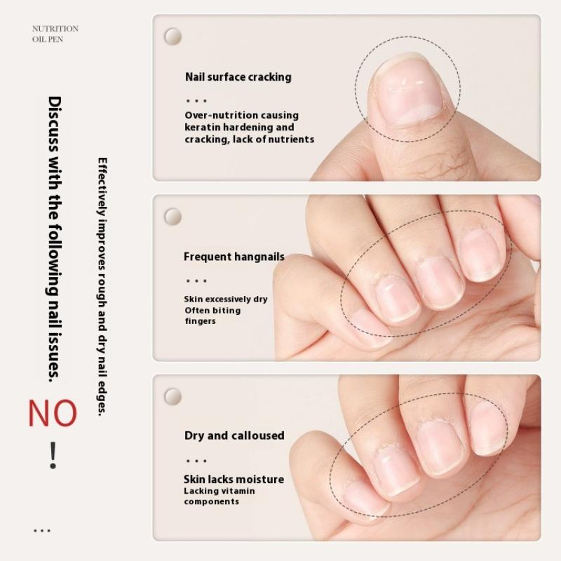 Olej do skórek Pielęgnacja paznokci Olej odżywczy Długopis Paznokcie Naprawa Dłoni 15 Zapachów 5 ml Żel do paznokci Odżywianie Skóry Długopis Manicure Leczenie