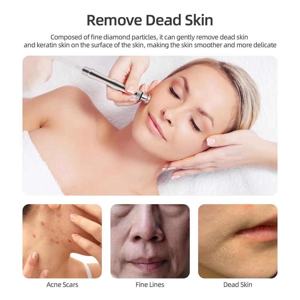 Macchina per microdermoabrasione al diamante Macchina per dermoabrasione Macchina per esfoliazione a spruzzo d'acqua Macchina per la bellezza Macchina per peeling del viso antirughe