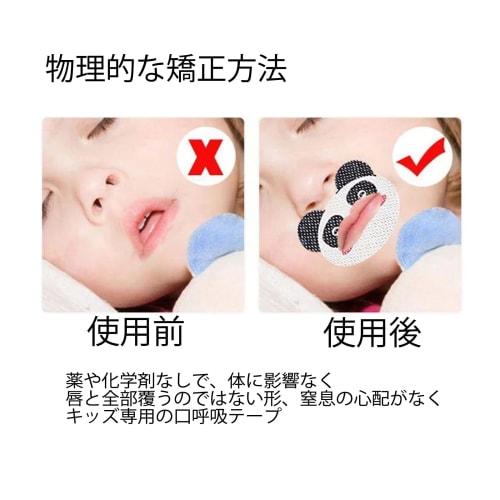 Mouth Closure Tape for Kids, Prevents Nasal Breathing, Prevents Adenoid Facies, Prevents Dry Throat, Promotes Nasal Breathing, Improves Sleep, and Pre