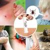 Sting Relief Insect Sting Sucker Vacuum Venom Extractor Emergency Tools   Insect Bite