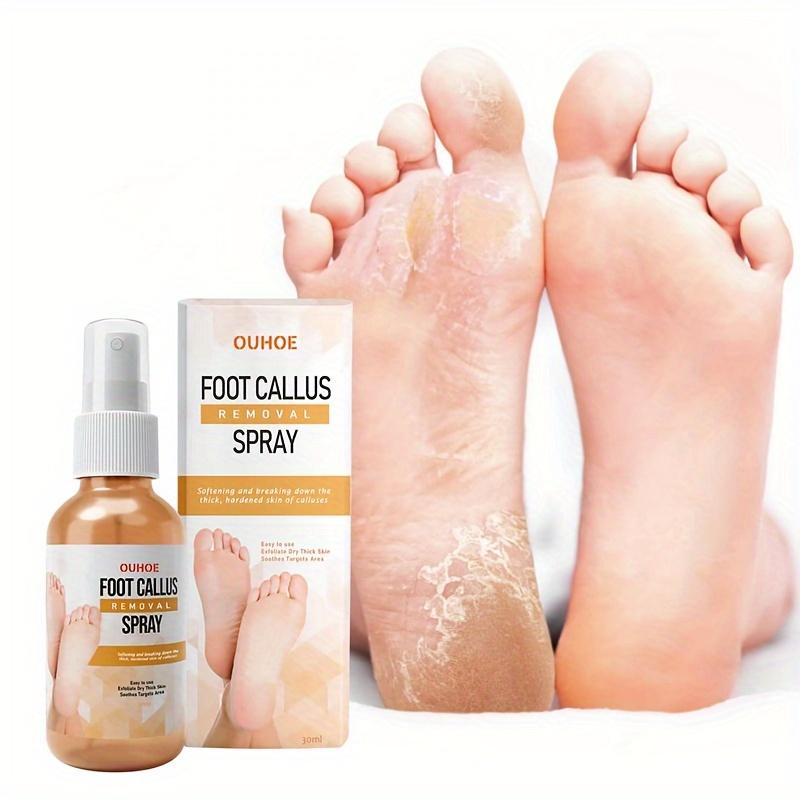 Fußspray zur Reinigung abgestorbener Haut, Hornhaut, Schwielen, zur Vorbeugung von Trockenheit, Rissen und zur Feuchtigkeitspflege der Hautspray
