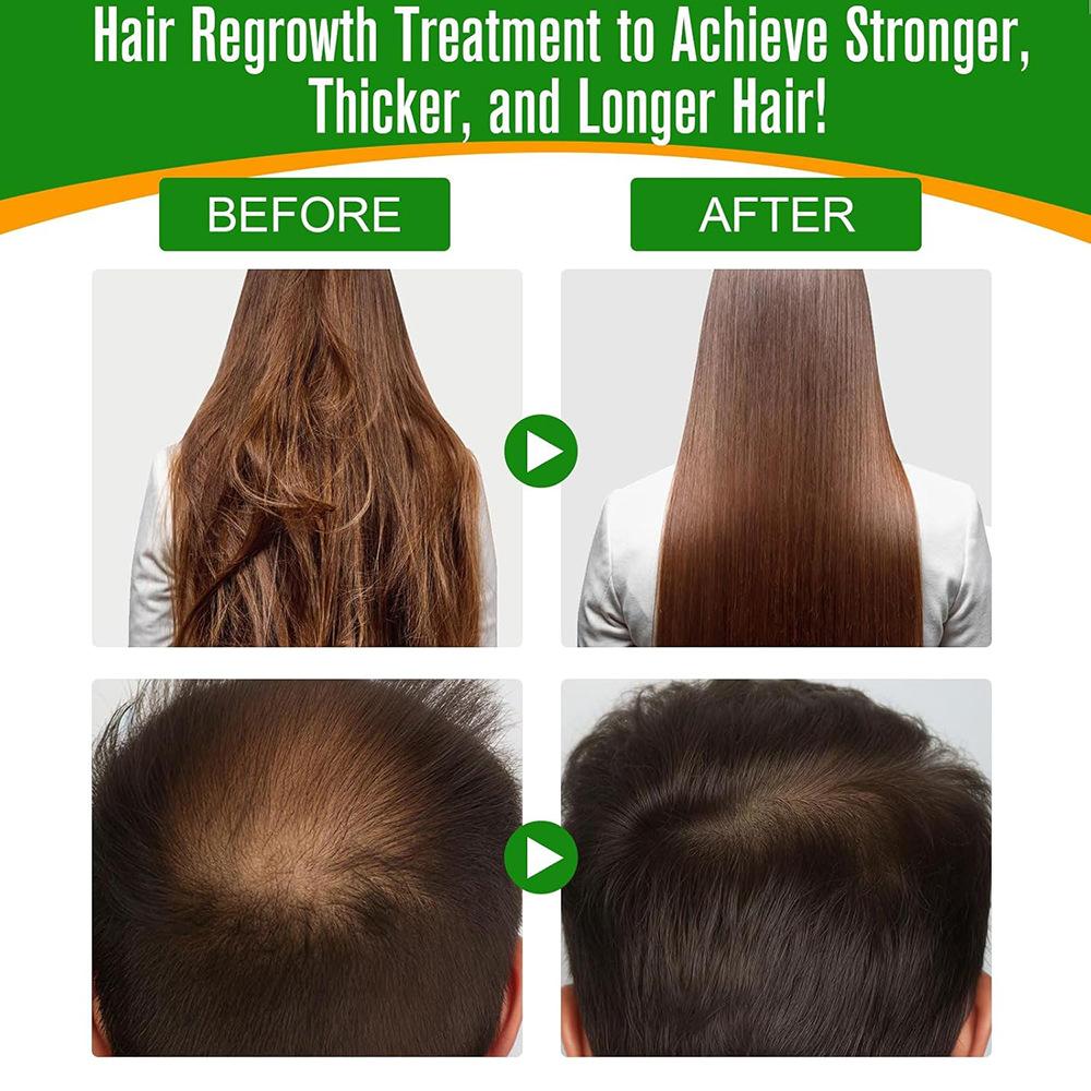 100% Pure & Natural Batana Oil Hair Growth Serum, Nourish Roots Strengthen Hair, 30ml