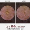 PEEL SHOT GLOW Brightening Exfoliating Rice Bran Ampoules (White Rice/Black Rice)