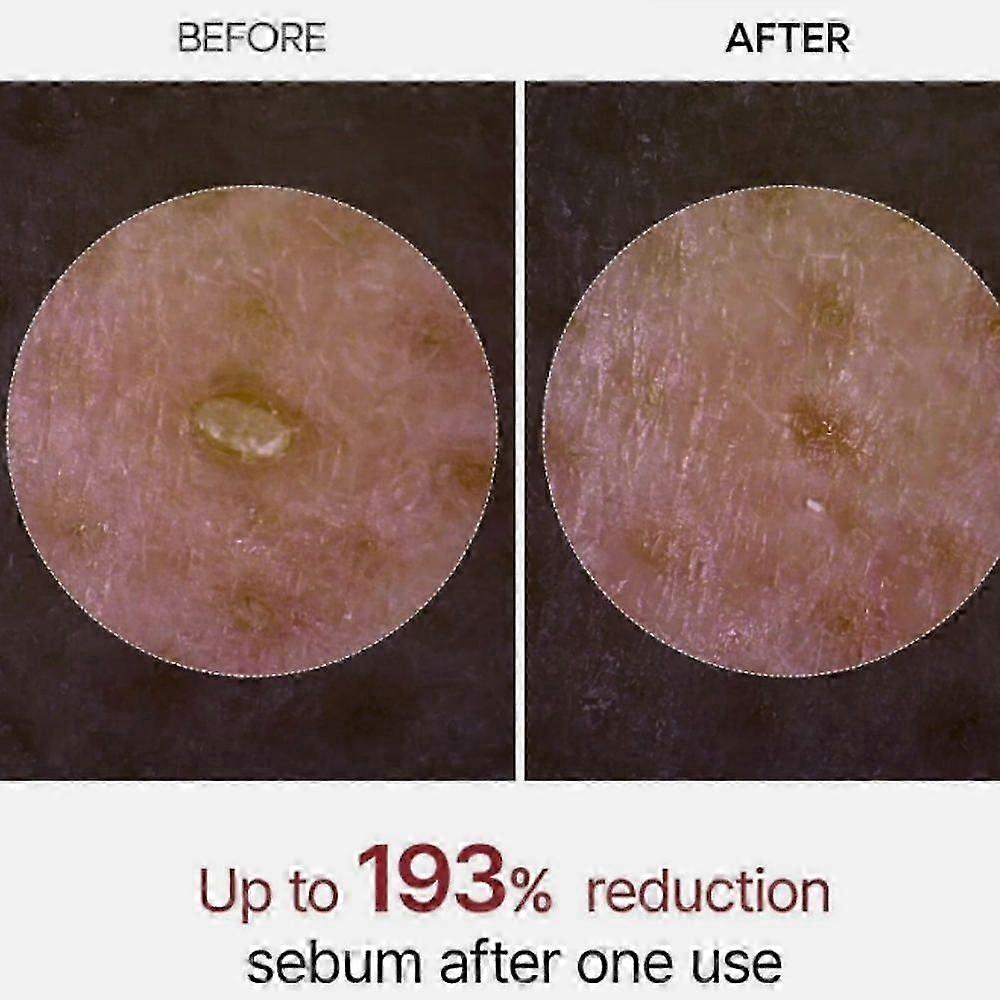 PEEL SHOT GLOW Brightening Exfoliating Rice Bran Ampoules (White Rice/Black Rice)