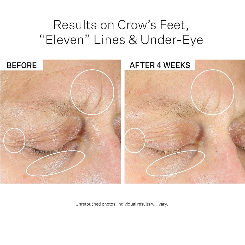 Strivectin Intensive Eye Cream Concentrate For Wrinkles Plus