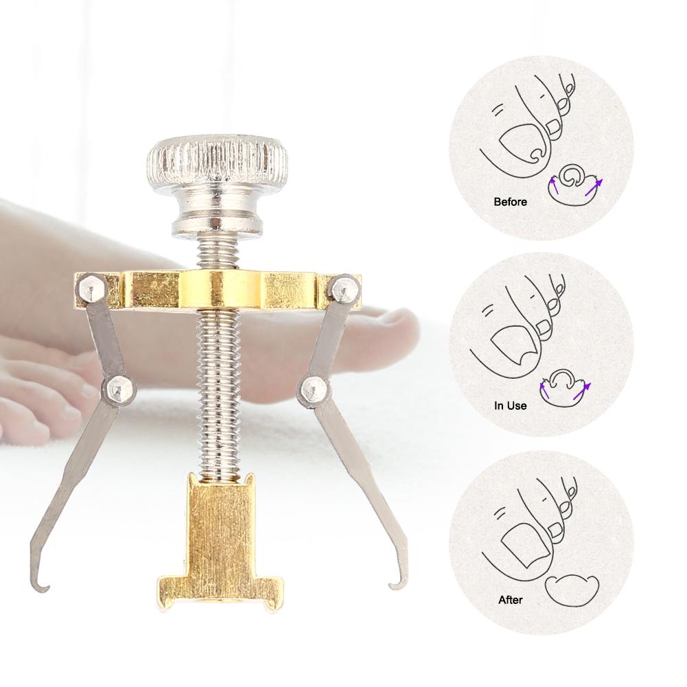 2PcsSet Foot Care Toenails Lifter Ingrown Nail Paronychia Correction File Pedicure Cleaner