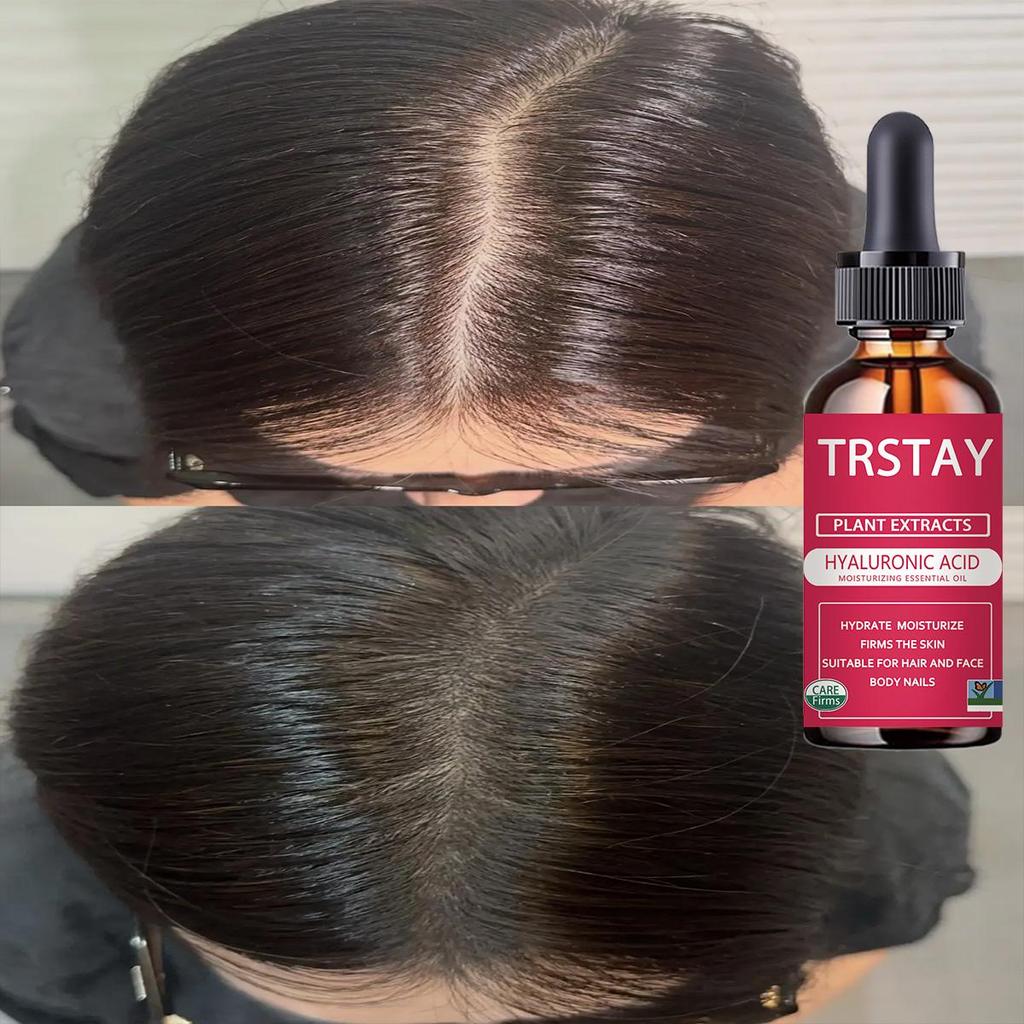 Hair Growth Serum Oil Fast Thick Natural Hair Care Scalp Reconstruction Prevent Hair Loss Damaged Hair Repair Products