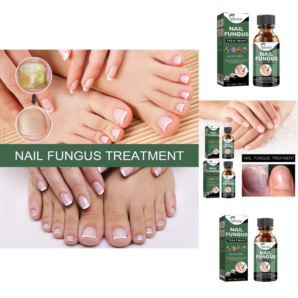 Eelhoe Nail Repair Liquid For Thick Toenails And Fungal Infections 50ml Ideal For Healthier Feet
